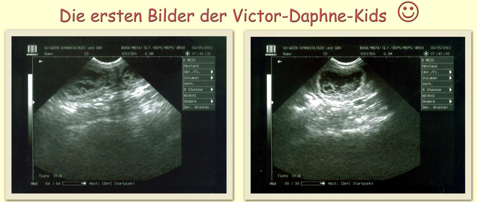 Ultraschallbilder vom 3.5.2011